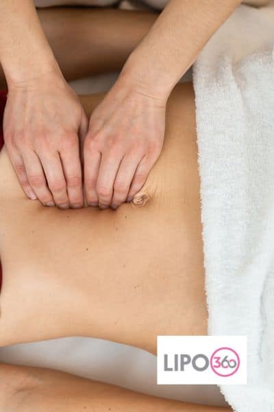 diastasis recti treatment Bridgend